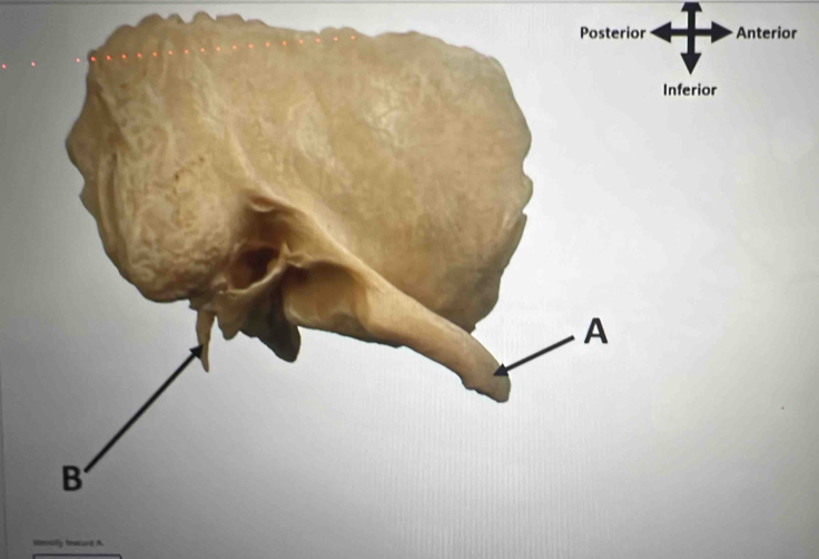 Anterior 
Inferior