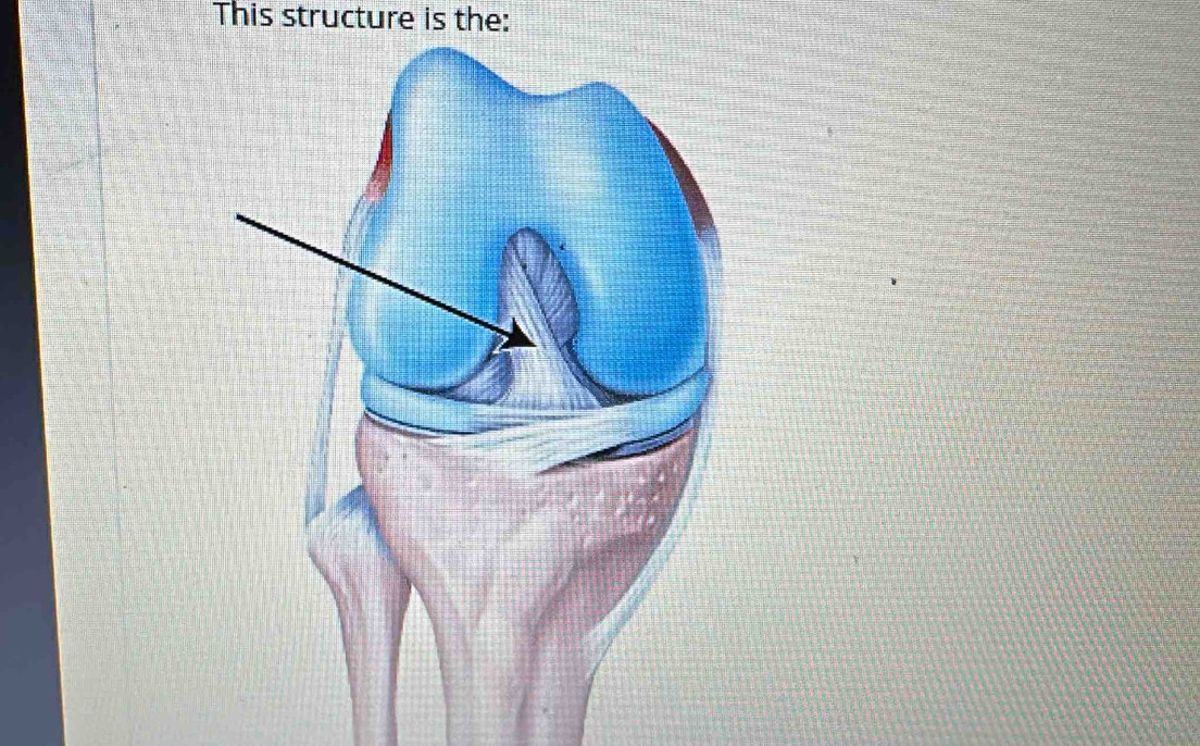 This structure is the: