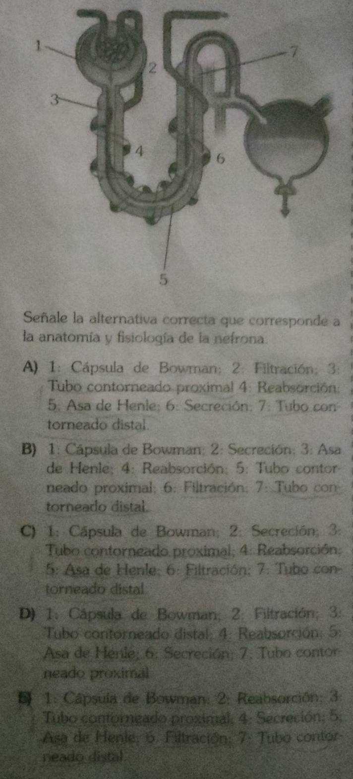 iva correcta que corresponde a
la anatomía y fisiología de la nefrona.
A). 1: Cápsula de Bowman; 2. Filtración; 3:
Tubo contorneado proximal 4: Reabsorción:
5. Asa de Henle; 6: Secreción; 7: Tubo con
torneado distal.
B) 1: Cápsula de Bowman; 2: Secreción: 3: Asa
de Henle; 4: Reabsorción; 5: Tubo contor
neado proximal; 6: Filtración: 7: Tubo con
torneado distal.
C) 1: Cápsula de Bowman; 2: Secreción; 3:
Tubo contorneado proximal; 4: Reabsorción;
5: Asa de Henle; 6: Filtración; 7: Tubo con-
torneado distal
D) 1: Cápsula de Bowman; 2: Filtración; 3:
Tubo contorneado distal: 4: Reabsorción; 5:
Asa de Hénle; 6: Secreción; 7. Tubo contor
neado proximal
1: Câpsula de Bowman: 2: Reabsorción; 3:
Tubo contorngado proximal; 4: Secreción; 5;
Asa de Henie, 6. Filtración: 7. Tubo contor-
neado distal.