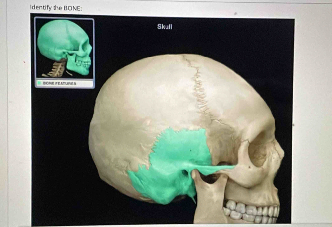 Identify the BONE: