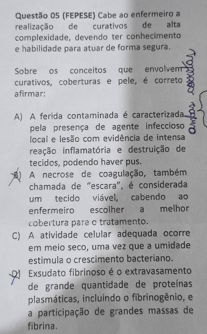 (FEPESE) Cabe ao enfermeiro a
realização de curativos de alta
complexidade, devendo ter conhecimento
e habilidade para atuar de forma segura.
Sobre os conceitos que envolvem
curativos, coberturas e pele, é correto
afirmar:
A) A ferida contaminada é caracterizada
pela presença de agente infeccioso
local e lesão com evidência de intensa
reação inflamatória e destruição de
tecidos, podendo haver pus.
B) A necrose de coagulação, também
chamada de "escara", é considerada
um tecido viável, cabendo ao
enfermeiro escolher a melhor
cobertura para o tratamento.
C) A atividade celular adequada ocorre
em meio seco, uma vez que a umidade
estimula o crescimento bacteriano.
Exsudato fibrinoso é o extravasamento
de grande quantidade de proteínas
plasmáticas, incluindo o fibrinogênio, e
a participação de grandes massas de
fibrina.