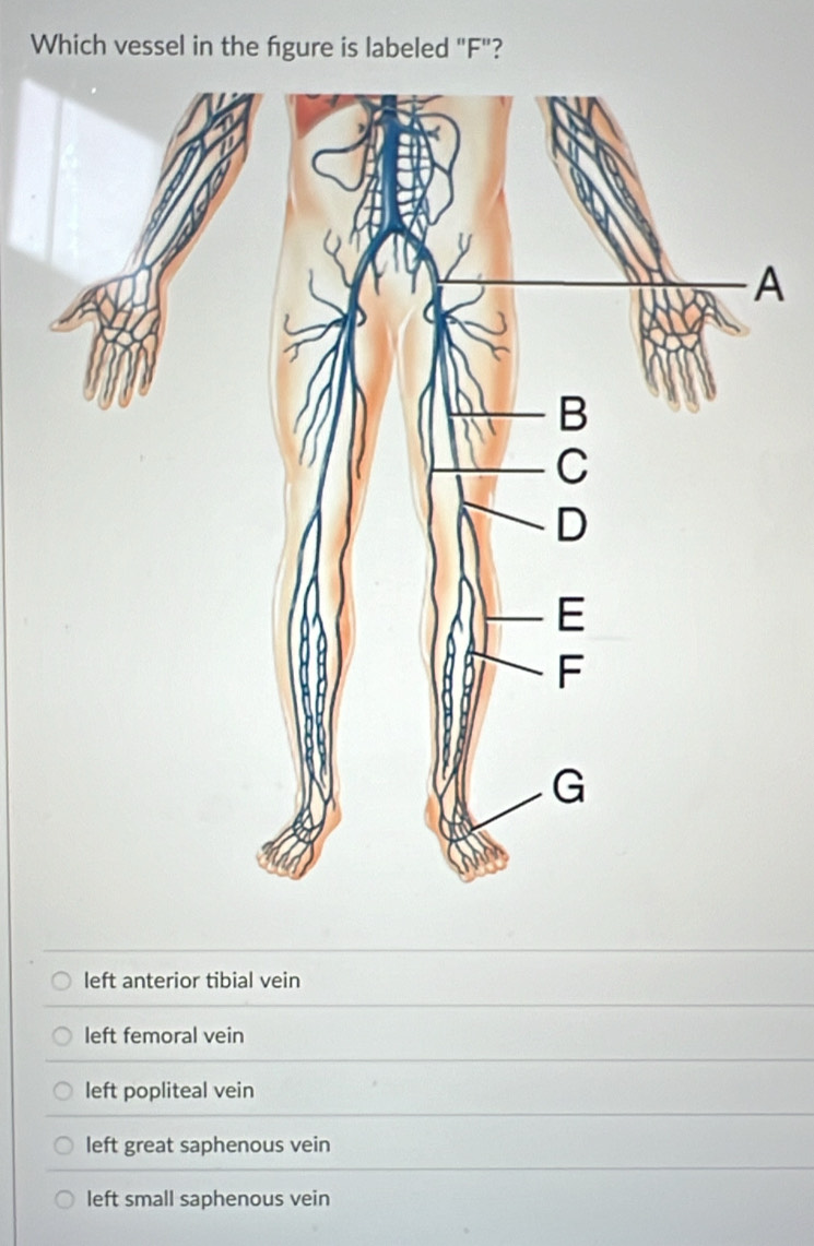 Which vessel in the fgure is labeled "F"?
A
left anterior tibial vein
left femoral vein
left popliteal vein
left great saphenous vein
left small saphenous vein