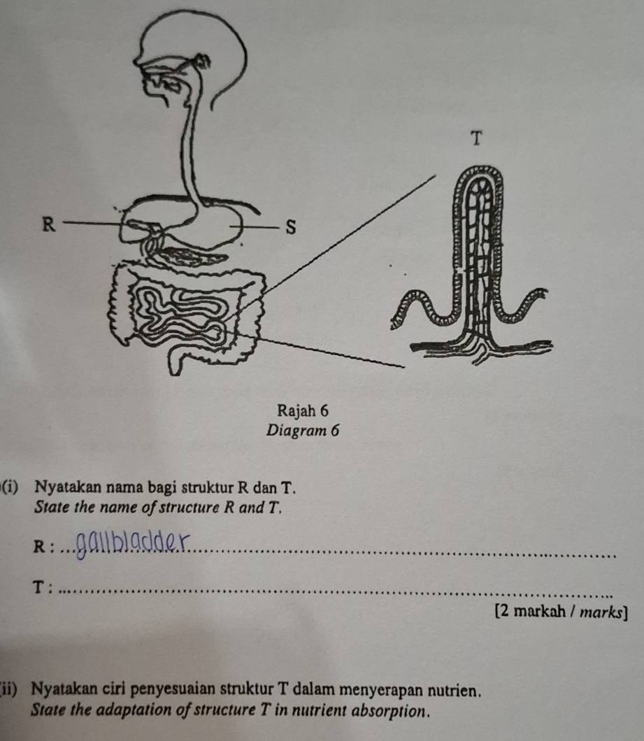 Nyatakan nama bagi struktur R dan T. 
State the name of structure R and T.
R : _
T :_ 
[2 markah / marks] 
(ii) Nyatakan ciri penyesuaian struktur T dalam menyerapan nutrien. 
State the adaptation of structure T in nutrient absorption.