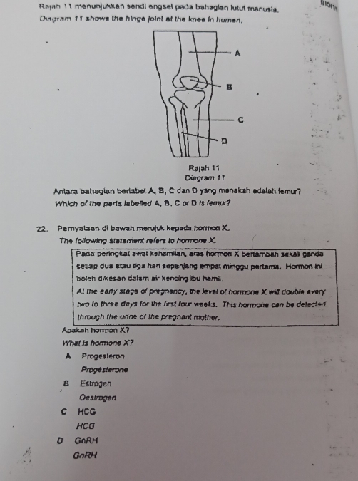 bom
Rajah 11 menunjukkan sendi engsel pada bahagian lutut manusia.
Dingram 11 shows the hinge joint at the knee in human.
Antara bahagian berlabel A. B. C dan D yang manaksh adalsh femur?
Which of the parts labelled A, B. C or D is femur?
22. Pernyalaan di bawah merujuk kepada hormon X.
The following statement refers to hormone X
Pada peringkat awal kehamilan, aras hormon X bertambah sekáli ganda
setiap dua stau liga hari sepanjang empal minggu pertama. Hormon ini
boteh dikesan dalam air kencing ibu hamil.
At the early stage of pregnancy, the level of hormone X will double every
two to three days for the first four weeks. This hormone can be delect-
through the urine of the pregnant mother.
Apakah hormón X
What is hormone X?
A Progesteron
Progé sterone
B Estrogen
Oestrogen
C HCG
HCG
D GnRH
GnRH