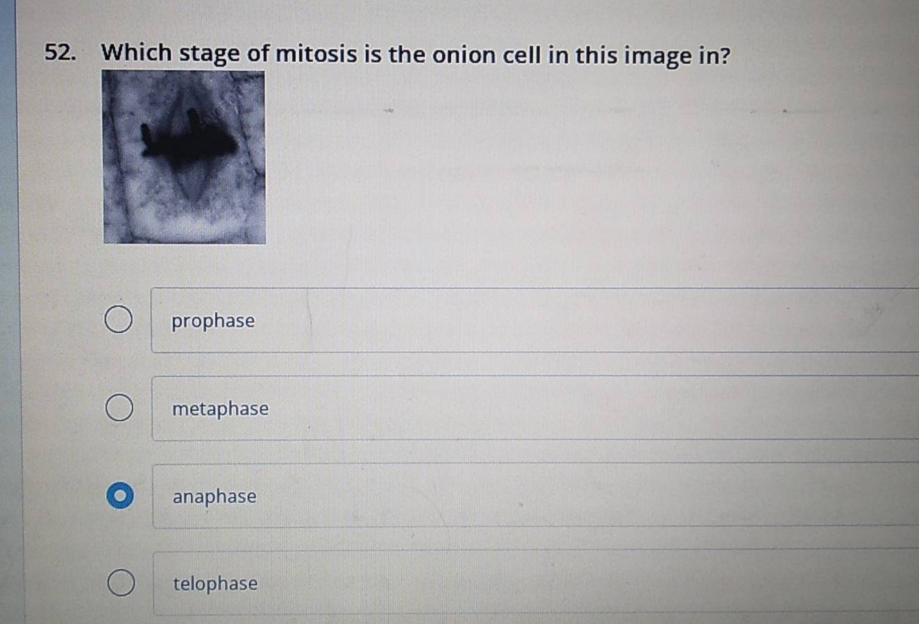 Which stage of mitosis is the onion cell in this image in?
prophase
metaphase
anaphase
telophase