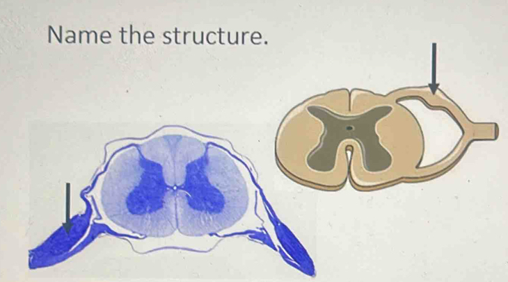 Name the structure. 
a