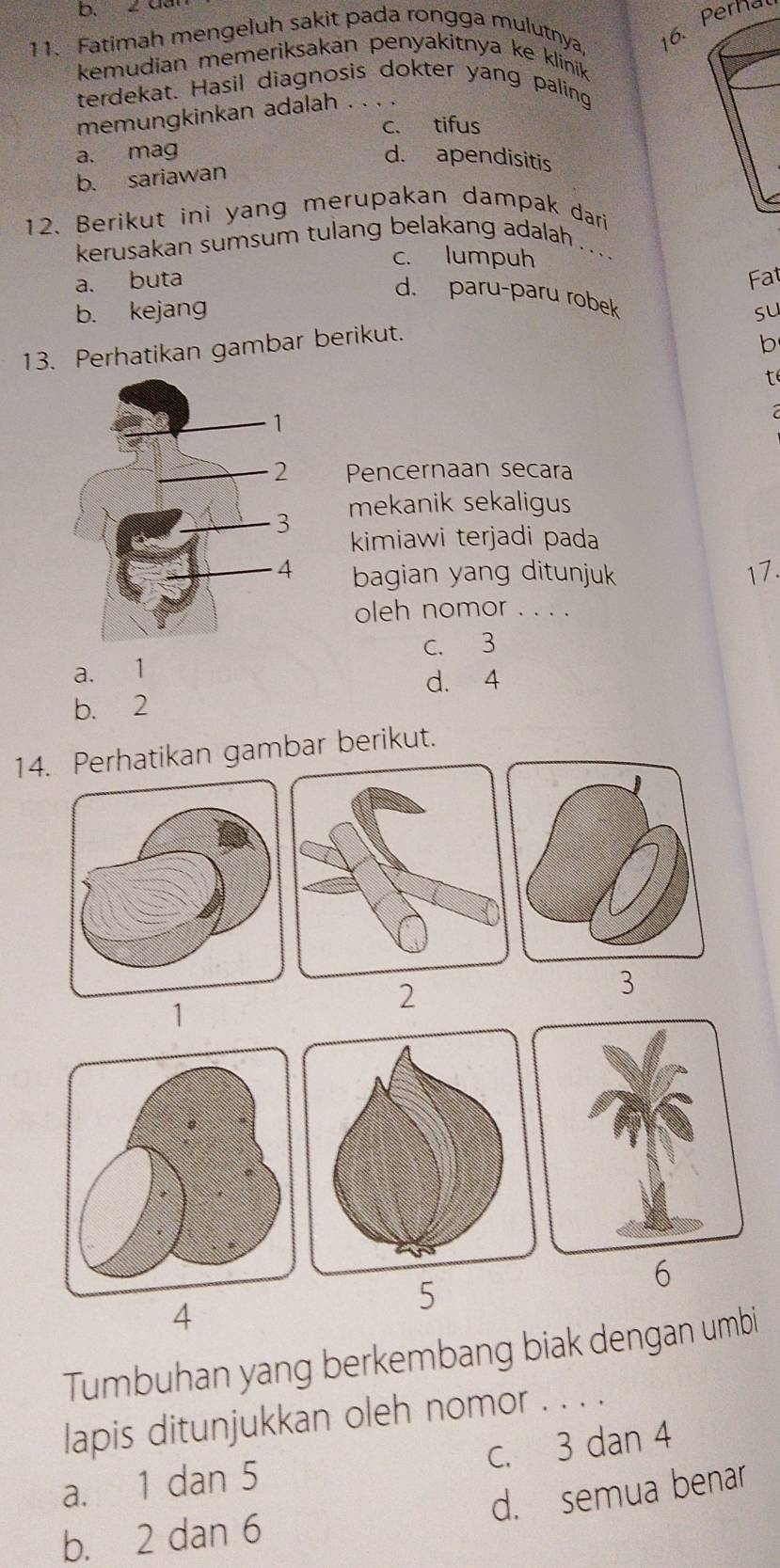 Ca
11. Fatimah mengeluh sakit pada rongga mulutnya, 6. Perhal
kemudian memeriksakan penyakitnya ke klinik
terdekat. Hasil diagnosis dokter yang paling
memungkinkan adalah . . .
c. tifus
a. mag d. apendisitis
b. sariawan
12. Berikut ini yang merupakan dampak dari
kerusakan sumsum tulang belakang adalah . .
c. lumpuh
a. buta Fat
d. paru-paru robek
b. kejang su
13. Perhatikan gambar berikut.
b
t
Pencernaan secara
mekanik sekaligus
kimiawi terjadi pada
bagian yang ditunjuk 11
oleh nomor . . . .
c. 3
a. 1
d. 4
b. 2
14. Perhatikan gambar berikut.
3
1
2
6
4
5
Tumbuhan yang berkembang biak dengan umbi
lapis ditunjukkan oleh nomor . . . .
a. 1 dan 5 c. 3 dan 4
d. semua benar
b. 2 dan 6