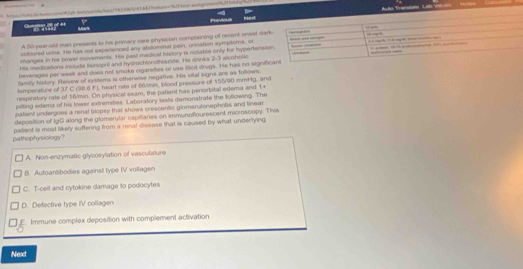 https://lwbs.lectuno.com/w/qb-test/atm/e/text/7433965/414427retarn=32Ftrst-assignmenc82fobby">
Previous Next Auto Translate Laf Value
'''B ' ''' Mark 
A 50-year-old man presents to his primary care physician complaining of recent onset da
coloured urine. He has not experienced any abdominal pain, urination symptoms, or
changes in his bowel movements. His past medical history is notable only for hypertens
His medications include lisinopril and hydrochlorothiazide. He drinks 2-3 alcoholic
beverages per week and does not smoke cigarettes or use illicit drugs. He has no signi
family history. Reivew of systems is otherwise negative. His vital signs are as follows:
temperature of 37 C (98.6 F), heart rate of 88/min, blood pressure of 155/90 mmHg, and
respiratory rate of 16/min. On physical exam, the patient has periorbital edema and 1 +
pitting edema of his lower extremities. Laboratory tests demonstrate the following. The
patient undergoes a renal biopsy that shows crescentic glomerulonephritis and linear
deposition of IgG along the glomerular capillaries on immunoflourescent microscopy. This
patient is most likely suffering from a renal disease that is caused by what underlying
pathophysiology?
A. Non-enzymatic glycosylation of vasculature
B. Autoantibodies against type IV vollagen
C. T-cell and cytokine damage to podocytes
D. Defective type IV collagen
E. Immune complex deposition with complement activation
Next