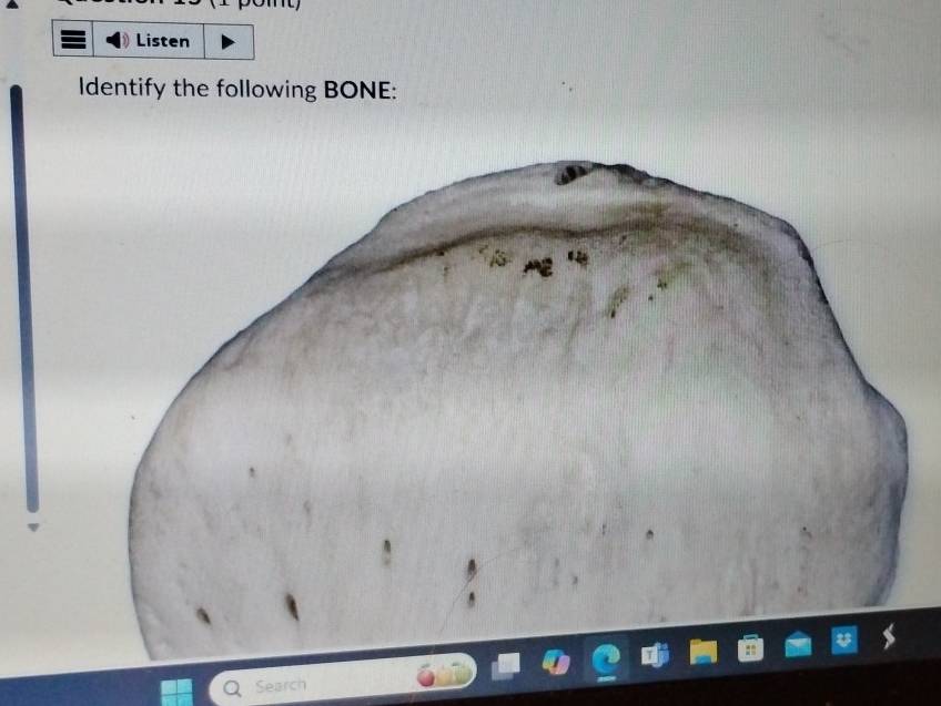 Listen 
Identify the following BONE: 
Search