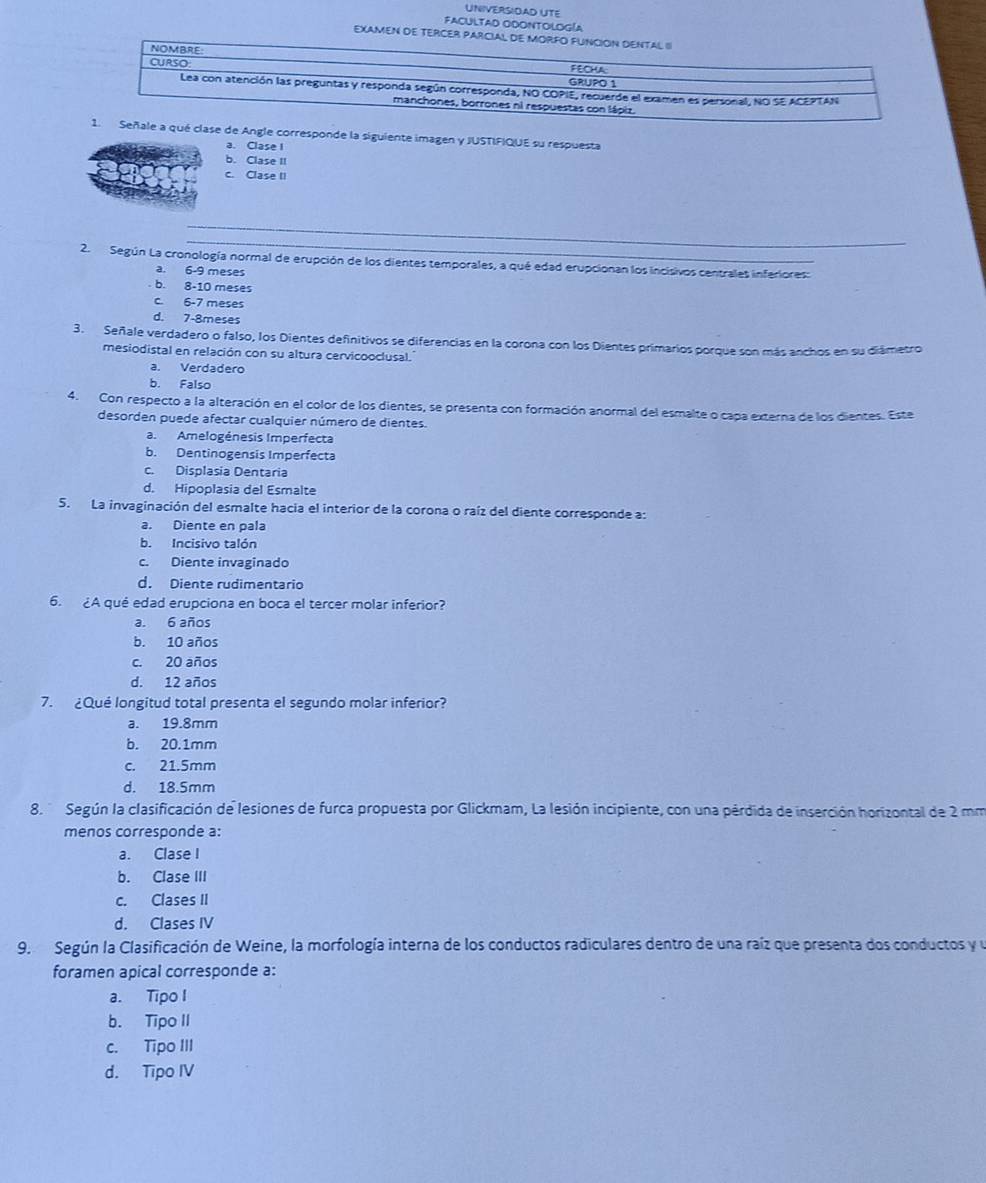 UNIVERSIDAD UTE
FACULTAD ODONTOLOGía
EXAMEN DE TERCER PAR
de Angle corresponde la siguiente imagen y JUSTIFIQUE su respuesta
a. Clase I
b. Clase II
c. Clase II
2.  Según La cronología normal de erupción de los dientes temporales, a qué edad erupcionan los incisivos centrales inferiores:
a. 6-9 meses
b. 8-10 meses
c. 6-7 meses
d. 7-8meses
3. Señale verdadero o falso, los Dientes definitivos se diferencias en la corona con los Dientes primarios porque son más anchos en su diámetro
mesiodistal en relación con su altura cervicooclusal.
a. Verdadero
b. Falso
4. Con respecto a la alteración en el color de los dientes, se presenta con formación anormal del esmalte o capa externa de los dientes. Este
desorden puede afectar cualquier número de dientes.
a. Amelogénesis Imperfecta
b. Dentinogensis Imperfecta
c. Displasia Dentaria
d. Hipoplasia del Esmalte
5. La invaginación del esmalte hacia el interior de la corona o raíz del diente corresponde a:
a. Diente en pala
b. Incisivo talón
c. Diente invaginado
d. Diente rudimentario
6. ¿A qué edad erupciona en boca el tercer molar inferior?
a. 6 años
b. 10 años
c. 20 años
d. 12 años
7. ¿Qué longitud total presenta el segundo molar inferior?
a. 19.8mm
b. 20.1mm
c. 21.5mm
d. 18.5mm
8.  Según la clasificación de lesiones de furca propuesta por Glickmam, La lesión incipiente, con una pérdida de inserción horizontal de 2 mm
menos corresponde a:
a. Clase I
b. Clase III
c. Clases II
d. Clases IV
9.  Según la Clasificación de Weine, la morfología interna de los conductos radiculares dentro de una raíz que presenta dos conductos y y
foramen apical corresponde a:
a. Tipo I
b. Tipo II
c. Tipo III
d. Tipo IV