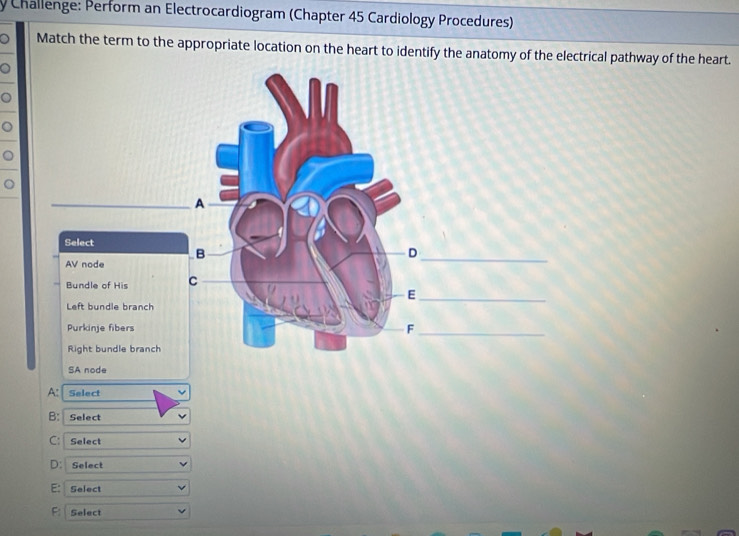 Challenge: Perform an Electrocardiogram (Chapter 45 Cardiology Procedures)
。 Match the term to the appropriate location on the heart to identify the anatomy of the electrical pathway of the heart.
。
。
。
。
SA node
A: Select
B: Select
C: Select
D：Select
E: Select
F Select