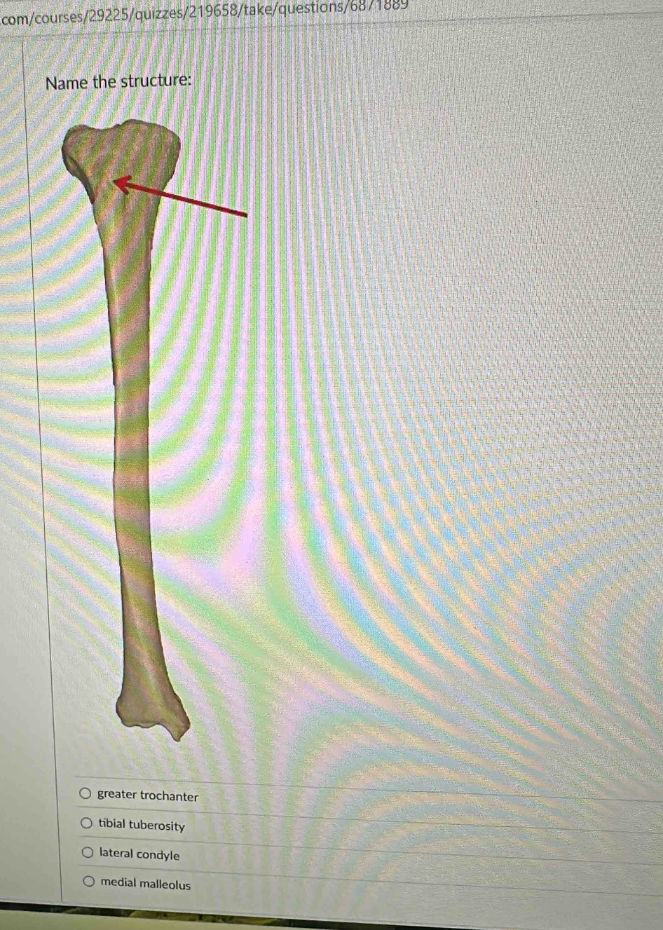 com/courses/29225/quizzes/219658/take/questions/68/1889
Name the structure:
greater trochanter
tibial tuberosity
lateral condyle
medial malleolus