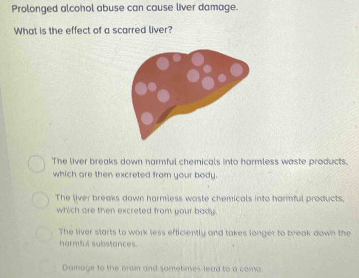 Prolonged alcohol abuse can cause liver damage.
What is the effect of a scarred liver?
The liver breaks down harmful chemicals into harmless waste products,
which are then excreted from your body.
The liver breaks down harmless waste chemicals into harmful products,
which are then excreted from your body.
The liver starts to work less efficiently and takes longer to break down the
harmful substances.
Damage to the brain and sometimes lead to a coma.