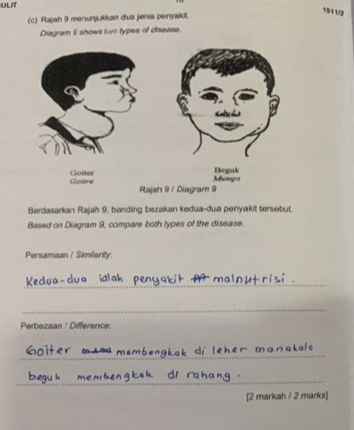 ULIT 
1511/2 
(c) Rajah 9 menunjukkan dua jenis penyakil. 
Diagram 8 shows two types of disease. 
Berdasarkan Rajah 9, banding bezakan kedua-dua penyakit tersebut. 
Based on Diagram 9, compare both types of the disease. 
Persamaan / Similarity. 
_ 
_ 
Perbezaan Difference: 
_ 
_ 
[2 markah / 2 marks]