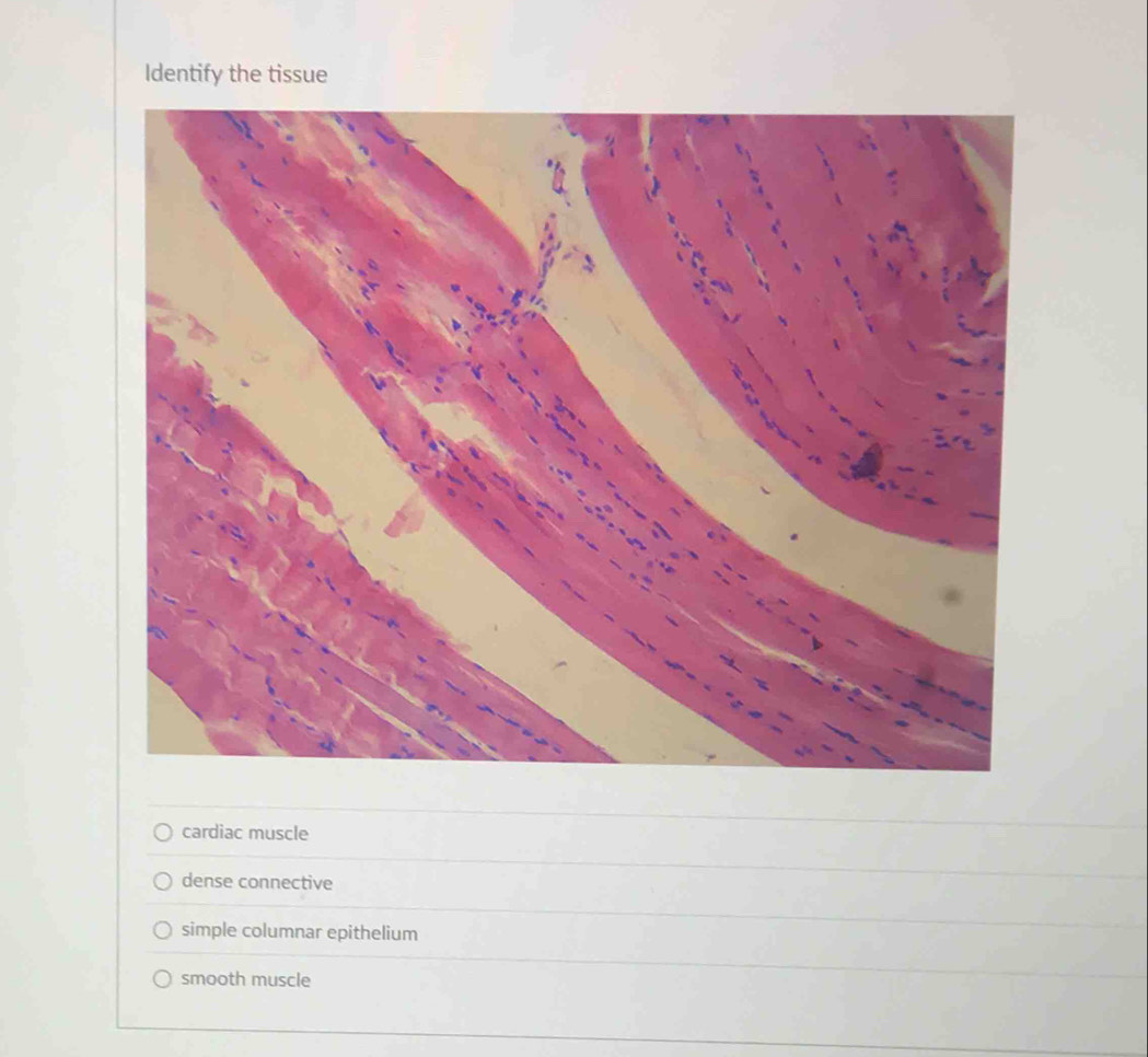 Identify the tissue
cardiac muscle
dense connective
simple columnar epithelium
smooth muscle