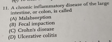 A chronic inflammatory disease of the large
intestine, or colon, is called
(A) Malabsorption
(B) Fecal impaction
(C) Crohn's disease
(D) Ulcerative colitis