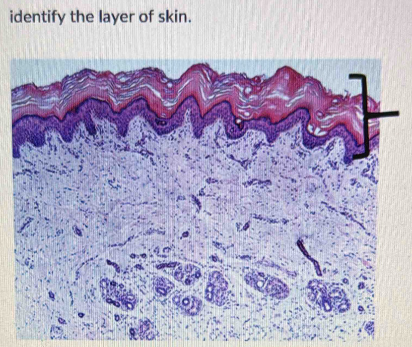 identify the layer of skin.