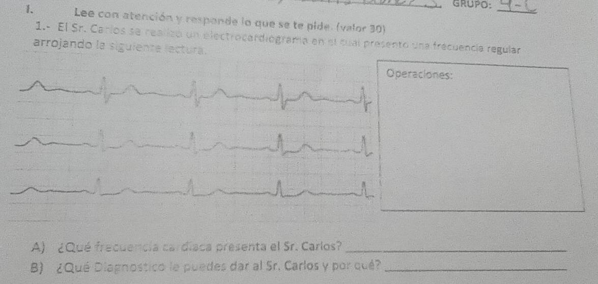 GRUPO: 
_ 
1. Lee con atención y responde lo que se te pide. (valor 30) 
1.- El Sr. Carlos se realizó un electrocardiograma en el cual presento una frecuencía regular 
arrojando la siguiente lectura. 
Operaciones: 
A) ¿Qué frecuencia cardíaca presenta el Sr. Carlos?_ 
B) ¿Qué Diagnostico le puedes dar al Sr. Carlos y por qué?_