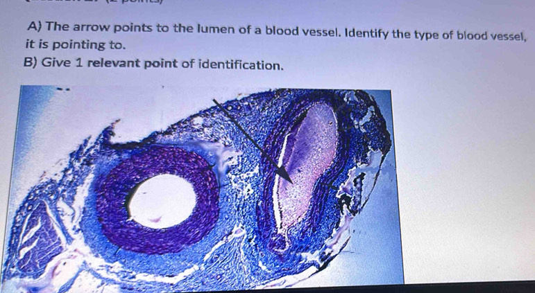 Solved: A The arrow points to the lumen of a blood vessel. Identify the ...