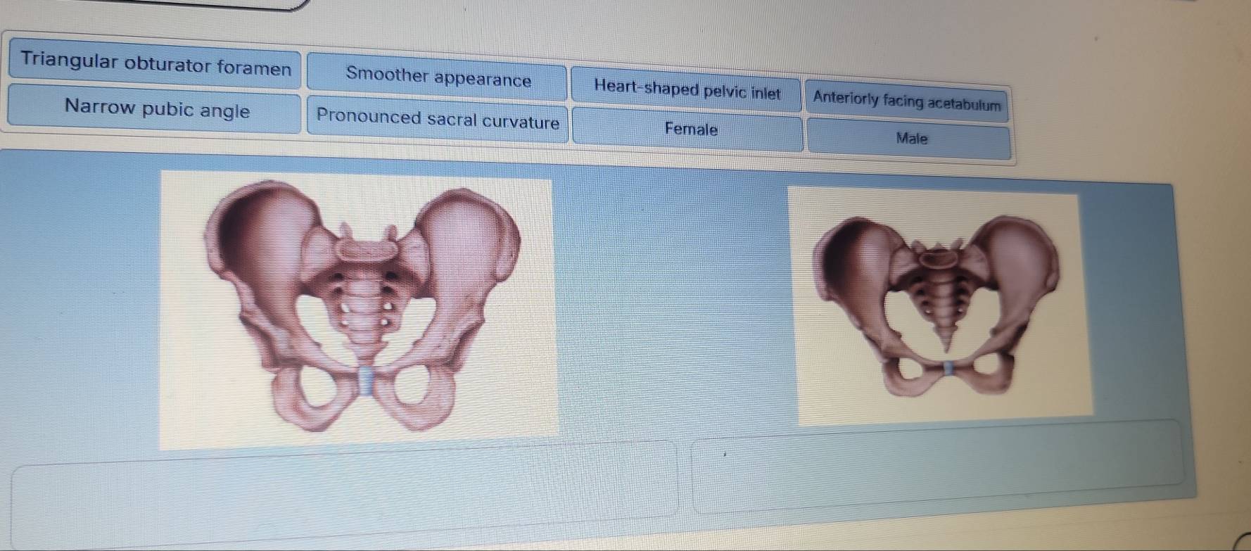 Solved: Triangular obturator foramen Smoother appearance Heart-shaped ...