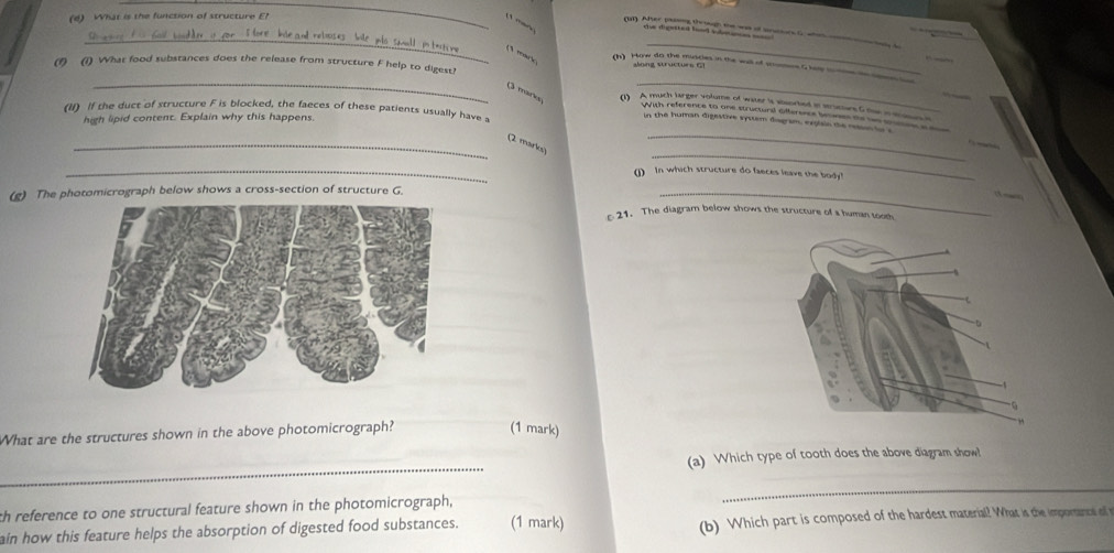 (6) What is the function of structure E? 
_ 
(3 mark 
_ 
(1) (1) What food substances does the release from structure F help to digest! along structurs G1 
_ 
(h) How do the muscles in the wall of summos Glay s 
mar (1) A much larger volume of water it msorted in structers G the n am 
(11) If the duct of structure F is blocked, the faeces of these patients usually have a 
_ 
With reference to one structural afference bewses the wo ses a 
high lipid content. Explain why this happens. 
in the human digestive syturm diagram, exglain te rson in s 
_ 
_(2 marico 
_1) In which structure do faeces leave the body! 
(g) The photomicrograph below shows a cross-section of structure G._ 
c 21. The diagram below shows the structure of a human tooth 
What are the structures shown in the above photomicrograph? 
(1 mark) 
_ 
(a) Which type of tooth does the above diagram show! 
th reference to one structural feature shown in the photomicrograph, 
_ 
ain how this feature helps the absorption of digested food substances. (1 mark) 
(b) Which part is composed of the hardest material? What is the importancas a