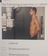 The following projection is called:
Lateral
Posteroanterior
Anteroposterior