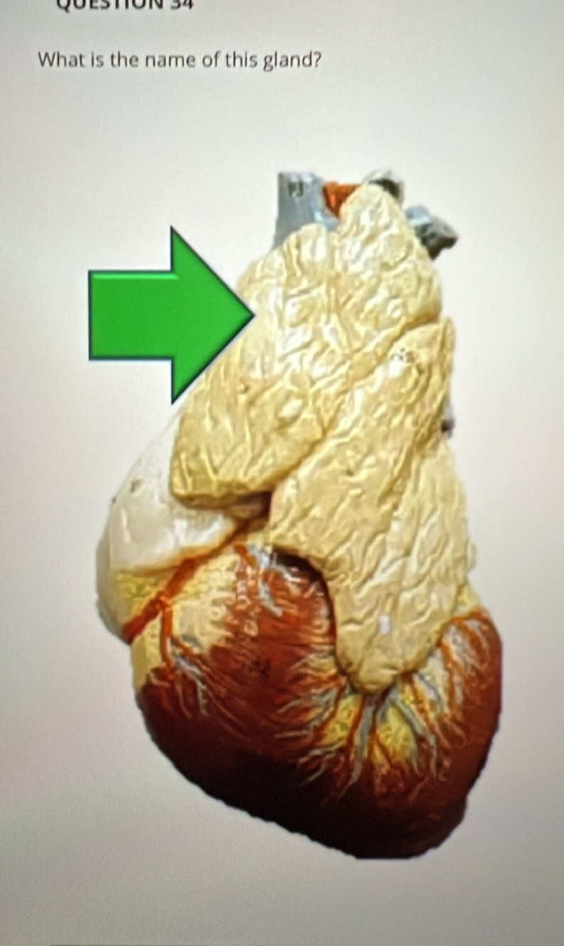 ON 34 
What is the name of this gland?