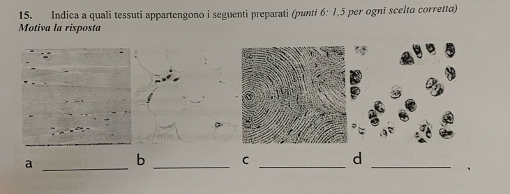 Indica a quali tessuti appartengono i seguenti preparati (punti 6: 1,5 per ogni scelta corretta) 
Motiva la risposta 
_a 
_b 
__ 
C 
d