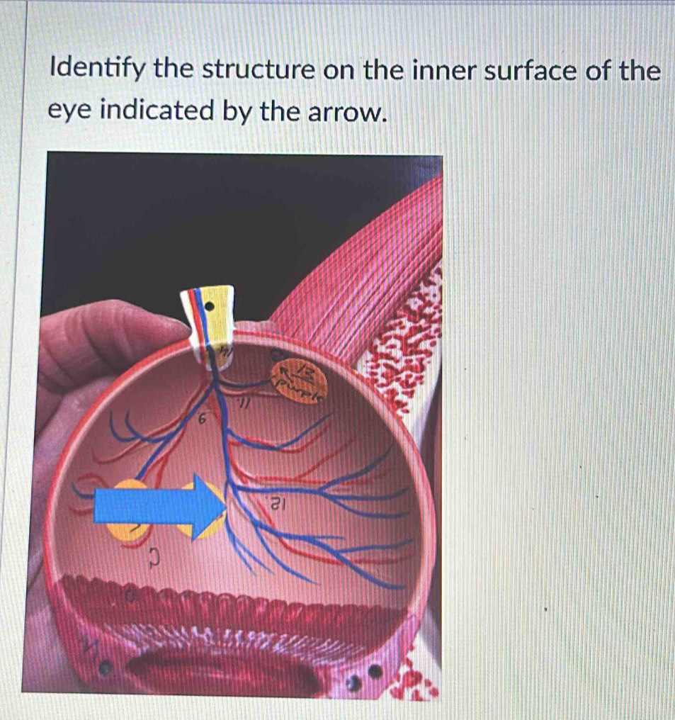 Identify the structure on the inner surface of the 
eye indicated by the arrow.