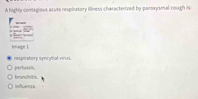 A highly contagious acute respiratory illness characterized by paroxysmal cough is:
r 
_ -
Image 1
respiratory syncytial virus.
pertussis.
bronchitis.
influenza.