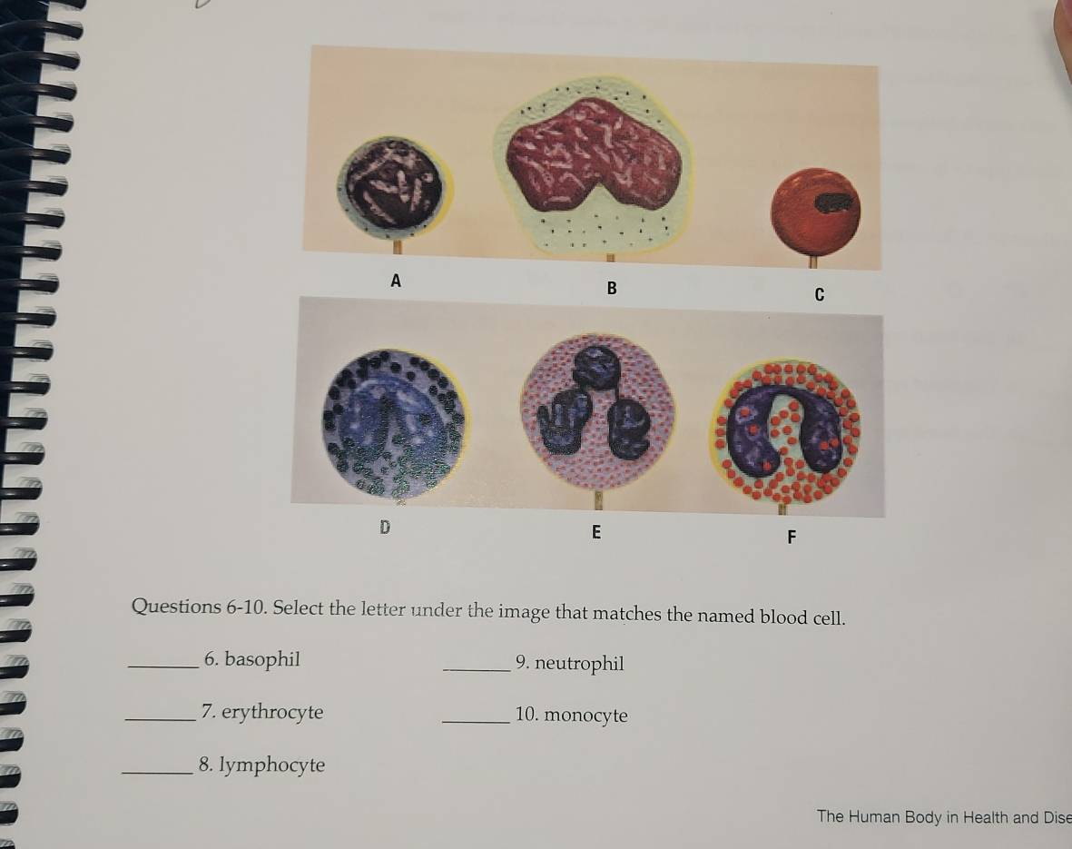 A 
B 
C 
D 
E 
F 
Questions 6-10. Select the letter under the image that matches the named blood cell. 
_6. basophil _9. neutrophil 
_7. erythrocyte _10. monocyte 
_8. lymphocyte 
The Human Body in Health and Dise