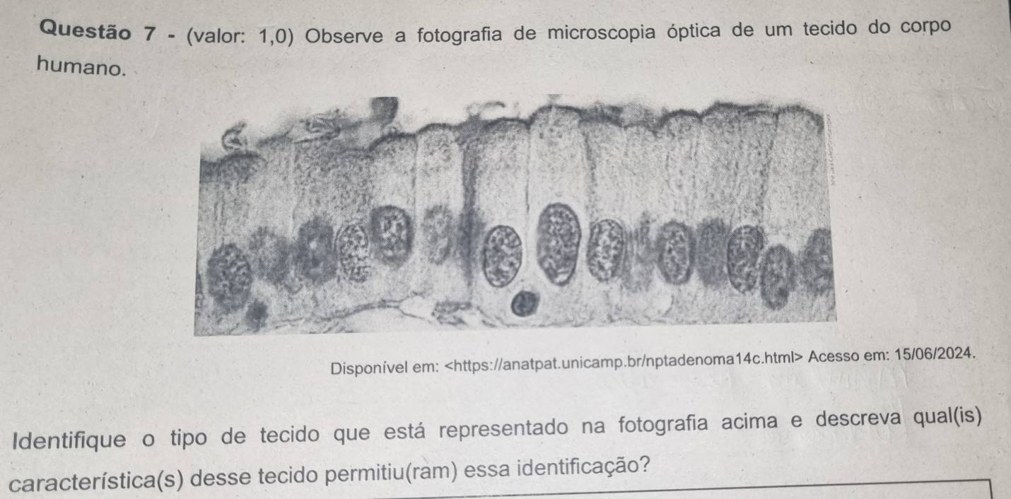 (valor: 1,0) Observe a fotografia de microscopia óptica de um tecido do corpo 
humano. 
Disponível em: Acesso em: 15/06/2024. 
Identifique o tipo de tecido que está representado na fotografia acima e descreva qual(is) 
característica(s) desse tecido permitiu(ram) essa identificação?