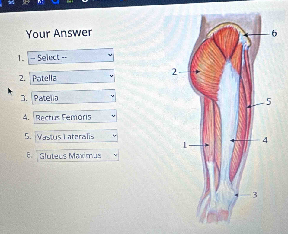 Your Answer 
1. -- Select -- 
2. Patella 
3. Patella 
4. Rectus Femoris 
5. Vastus Lateralis 
6. Gluteus Maximus