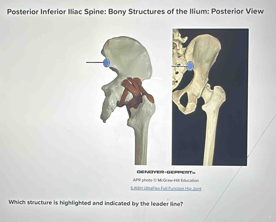 Posterior Inferior Iliac Spine: Bony Structures of the Ilium: Posterior View 
DENOYER-GEPPERT. 
APR photo © McGraw-Hill Education 
SJ66H UltraFlex Full Function Hip Joint 
Which structure is highlighted and indicated by the leader line?