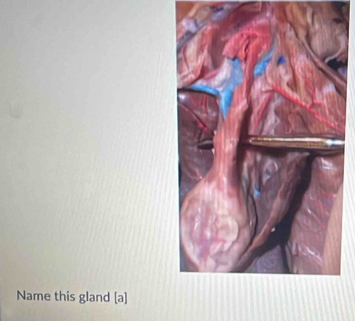 Name this gland [a]