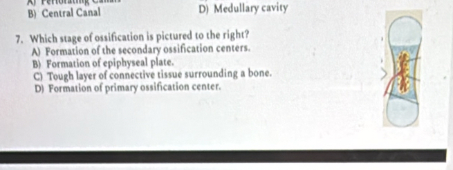 B) Central Canal D) Medullary cavity
7. Which stage of ossification is pictured to the right?
A) Formation of the secondary ossification centers.
B) Formation of epiphyseal plate.
C) Tough layer of connective tissue surrounding a bone.
D) Formation of primary ossification center.