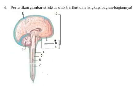 Perhatikan gambar struktur otak berikut dan lengkapi bagian-bagiannya!