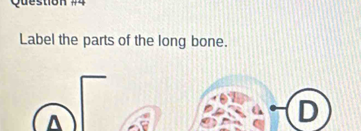 Label the parts of the long bone.