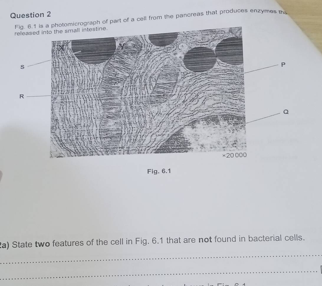 a photomicrograph of part of a cell from the pancreas that produces enzymes th 
Fig. 6.1 
2a) State two features of the cell in Fig. 6.1 that are not found in bacterial cells. 
_ 
_