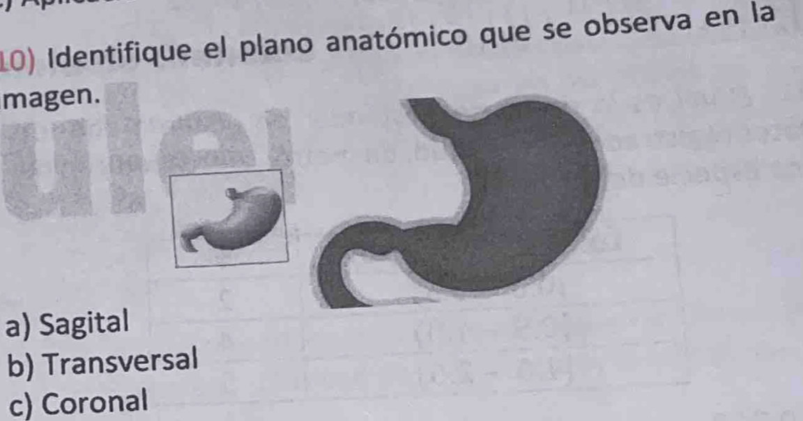 Identifique el plano anatómico que se observa en la
magen.
a) Sagital
b) Transversal
c) Coronal