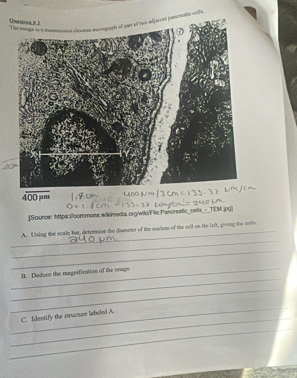 cells,
overline 400mu m
[Source: https://commons.wikimedia.org/wiki/File:Pancreatic_cells_-_TEM.jpg] 
_ 
_A. Using the scale bar, determine the diameter of the nucleus of the cell on the left, giving the units. 
_ 
_ 
_ 
B. Deduce the magnification of the image. 
_ 
_ 
_ 
C. Identify the structure labeled A. 
_