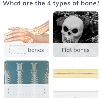 What are the 4 types of bone? 
bones