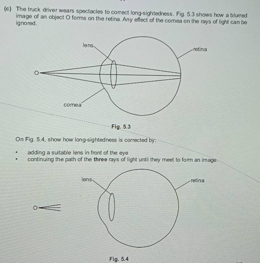 The truck driver wears spectacles to correct long-sightedness. Fig. 5.3 shows how a blurred 
image of an object O forms on the retina. Any effect of the cornea on the rays of light can be 
ig no red . 
Fig. 5.3 
On Fig. 5.4, show how long-sightedness is corrected by: 
adding a suitable lens in front of the eye 
continuing the path of the three rays of light until they meet to form an image. 
0 
Fig. 5.4