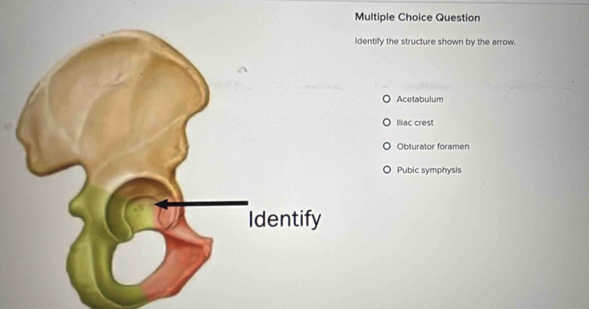 Question
dentify the structure shown by the arrow.
Acetabulum
Iliac crest
Obturator foramen
Pubic symphysis