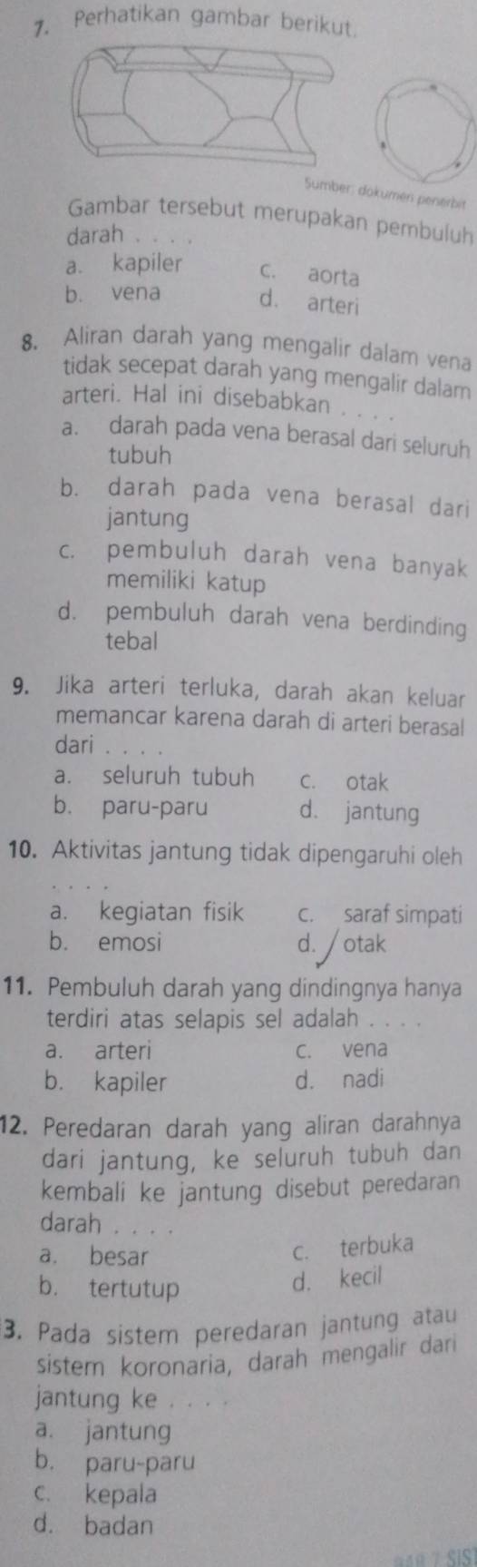 Perhatikan gambar berikut.
Sumber: dokumen penerbit
Gambar tersebut merupakan pembuluh
darah .
a. kapiler c. aorta
b. vena
d. arteri
8. Aliran darah yang mengalir dalam vena
tidak secepat darah yang mengalir dalam
arteri. Hal ini disebabkan . . .
a. darah pada vena berasal dari seluruh
tubuh
b. darah pada vena berasal dari
jantung
c. pembuluh darah vena banyak
memiliki katup
d. pembuluh darah vena berdinding
tebal
9. Jika arteri terluka, darah akan keluar
memancar karena darah di arteri berasal
dari
a. seluruh tubuh c. otak
b. paru-paru d. jantung
10. Aktivitas jantung tidak dipengaruhi oleh
a. kegiatan fisik c. saraf simpati
b. emosi d. /otak
11. Pembuluh darah yang dindingnya hanya
terdiri atas selapis sel adalah
a. arteri c. vena
b. kapiler d. nadi
12. Peredaran darah yang aliran darahnya
dari jantung, ke seluruh tubuh dan
kembali ke jantung disebut peredaran
darah . . .
a. besar
c. terbuka
b. tertutup
d. kecil
3. Pada sistem peredaran jantung atau
sistem koronaria, darah mengalir dari
jantung ke . . . .
a. jantung
b. paru-paru
c. kepala
d. badan