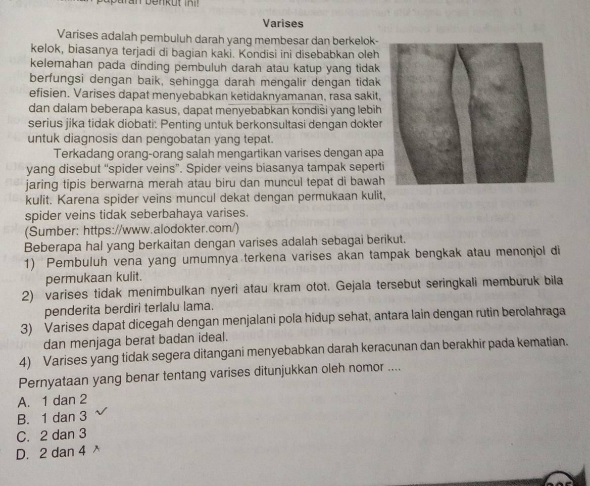 baran benkut ini!
Varises
Varises adalah pembuluh darah yang membesar dan berkelok-
kelok, biasanya terjadi di bagian kaki. Kondisi ini disebabkan oleh
kelemahan pada dinding pembuluh darah atau katup yang tidak
berfungsi dengan baik, sehingga darah mengalir dengan tidak
efisien. Varises dapat menyebabkan ketidaknyamanan, rasa sakit,
dan dalam beberapa kasus, dapat menyebabkan kondisi yang lebih
serius jika tidak diobati: Penting untuk berkonsultasi dengan dokter
untuk diagnosis dan pengobatan yang tepat.
Terkadang orang-orang salah mengartikan varises dengan apa
yang disebut “spider veins”. Spider veins biasanya tampak sepert
jaring tipis berwarna merah atau biru dan muncul tepat di bawah
kulit. Karena spider veins muncul dekat dengan permukaan kulit,
spider veins tidak seberbahaya varises.
(Sumber: https://www.alodokter.com/)
Beberapa hal yang berkaitan dengan varises adalah sebagai berikut.
1) Pembuluh vena yang umumnya terkena varises akan tampak bengkak atau menonjol di
permukaan kulit.
2) varises tidak menimbulkan nyeri atau kram otot. Gejala tersebut seringkali memburuk bila
penderita berdiri terlalu lama.
3) Varises dapat dicegah dengan menjalani pola hidup sehat, antara lain dengan rutin berolahraga
dan menjaga berat badan ideal.
4) Varises yang tidak segera ditangani menyebabkan darah keracunan dan berakhir pada kematian.
Pernyataan yang benar tentang varises ditunjukkan oleh nomor ...._
A. 1 dan 2
B. 1 dan 3
C. 2 dan 3
D. 2 dan 4