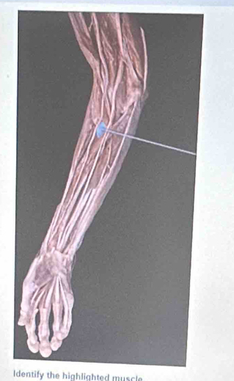 Identify the highlighted muscle