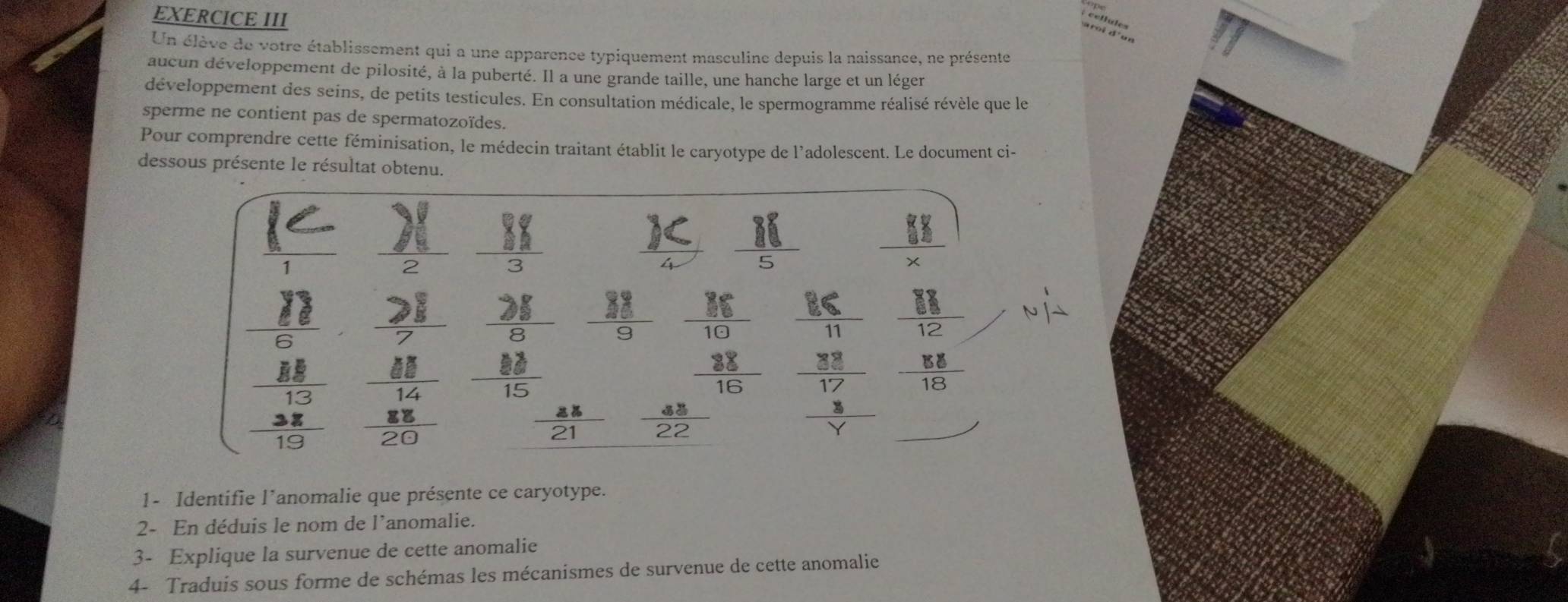 EXERCICE III 
; cellules 
Un élève de votre établissement qui a une apparence typiquement masculine depuis la naissance, ne présente 
aucun développement de pilosité, à la puberté. Il a une grande taille, une hanche large et un léger 
développement des seins, de petits testicules. En consultation médicale, le spermogramme réalisé révèle que le 
sperme ne contient pas de spermatozoïdes. 
Pour comprendre cette féminisation, le médecin traitant établit le caryotype de l'adolescent. Le document ci- 
dessous présente le résultat obtenu.
beginarrayr K 1endarray 2 
_  11/5 
25  88/9   86/10   88/12  v'-
□  □ 
beginarrayr _ overline _ 23 _ frac 88 _ -_ 3 _ 15 hline 15endarray beginarrayr _ frac _ 8 frac lg 20endarray  88/15   88/16  beginarrayr  38/17   8/Y endarray  88/18 
 ax/21   48/22 
1- Identifie l’anomalie que présente ce caryotype. 
2- En déduis le nom de l’anomalie. 
3- Explique la survenue de cette anomalie 
4- Traduis sous forme de schémas les mécanismes de survenue de cette anomalie