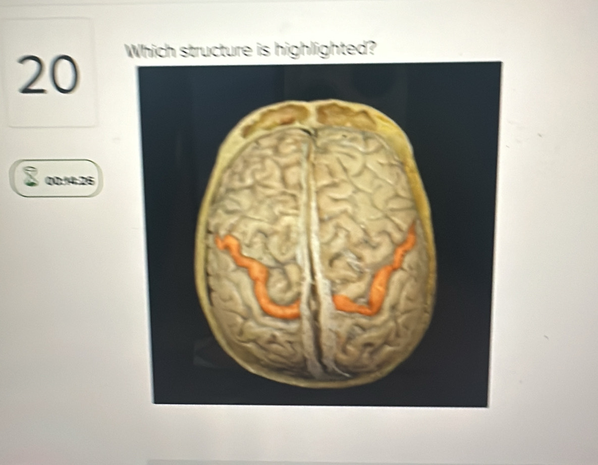 Which structure is highlighted?
I 00:14:26