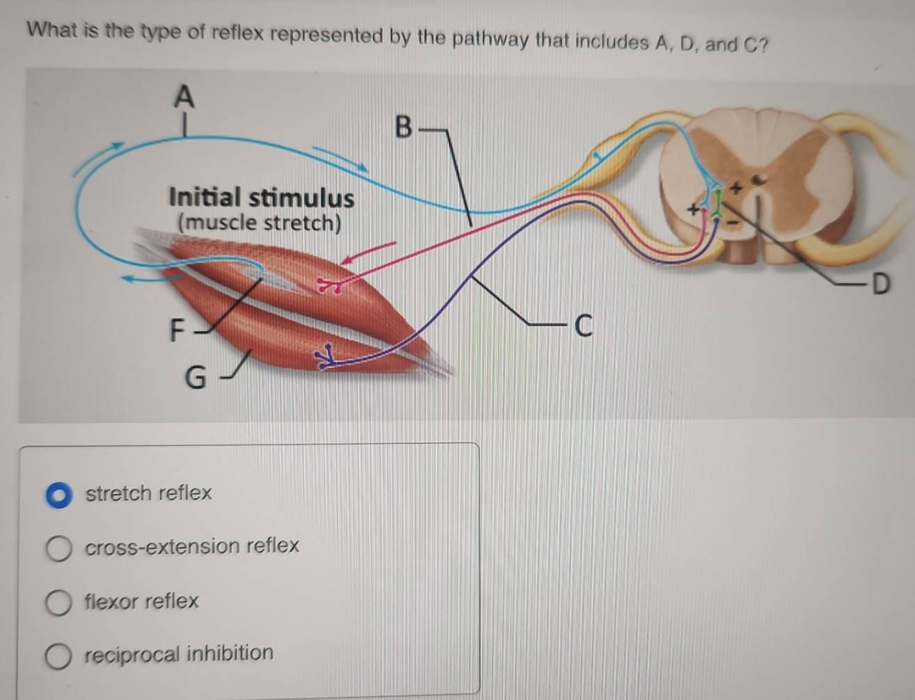 Solved: What is the type of reflex represented by the pathway that ...
